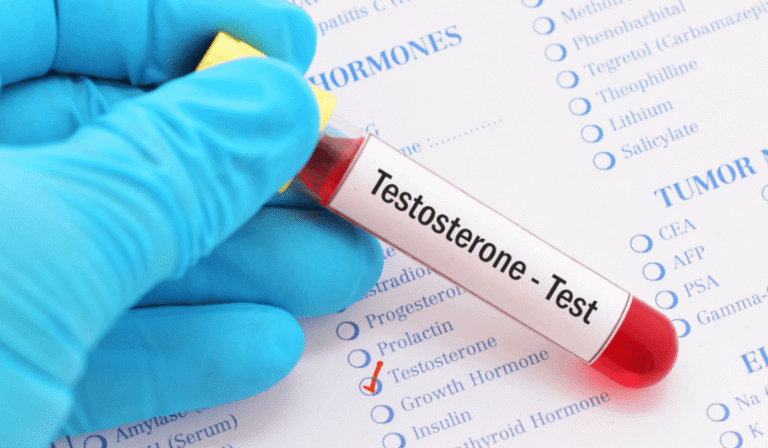 Buy Sustanon Online – Premium Testosterone Blend for Sustained Gains & Strength Testosterone