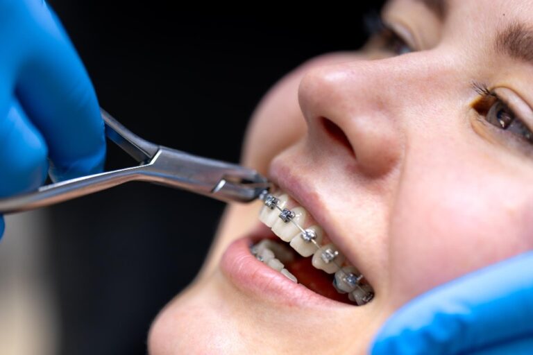 Orthodontics Penrith: Straightening Smiles with Cutting-Edge Tech