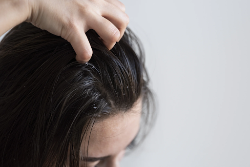 How PRP Hair Restoration Supports Recovery from Hormonal Imbalance Hair Loss in Brighton